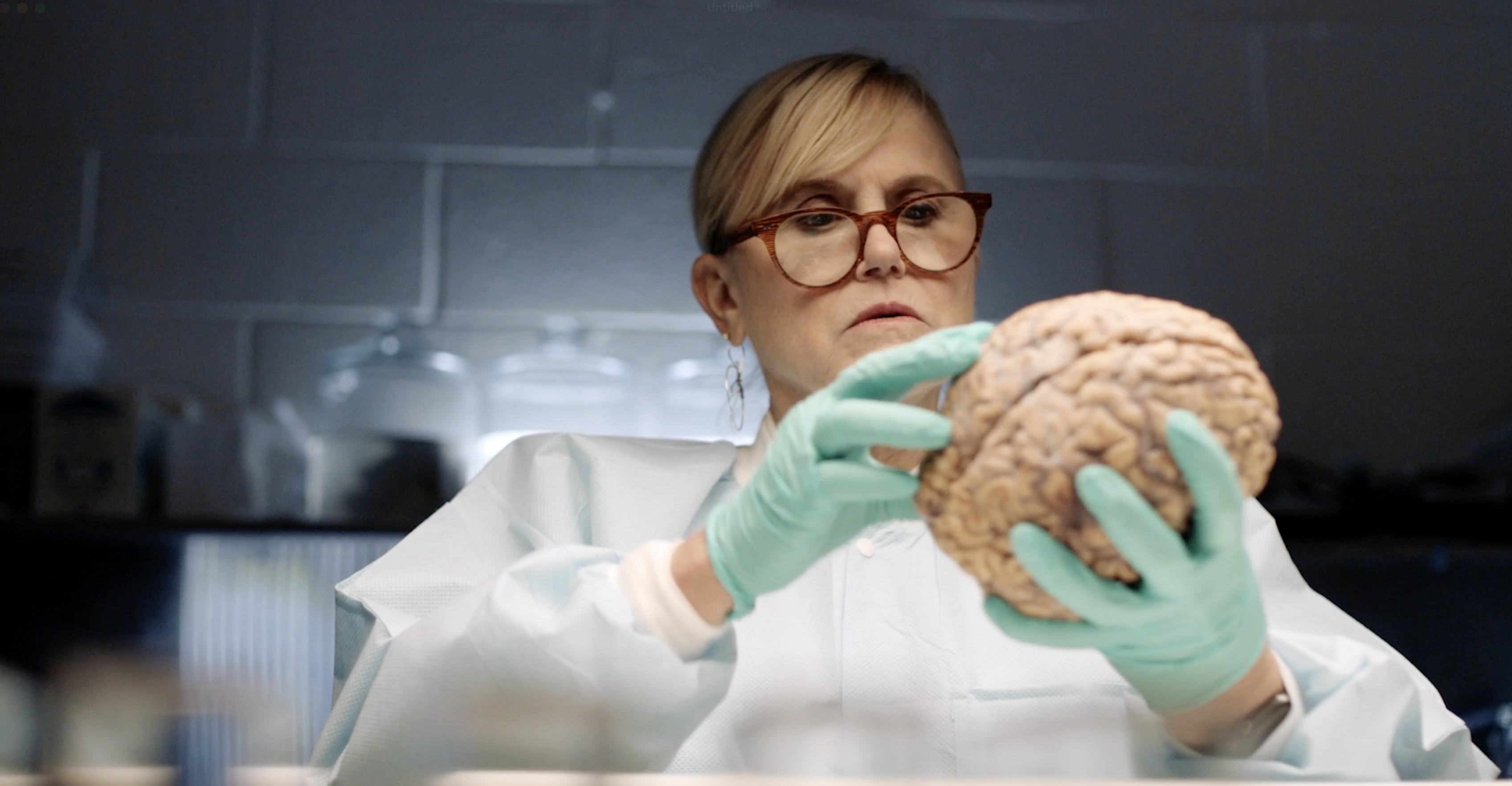 Ann McKee holding a brain